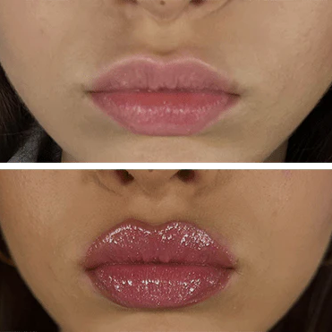 Voluxe™ Extreme Lip Plumper