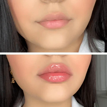 Voluxe™ Extreme Lip Plumper