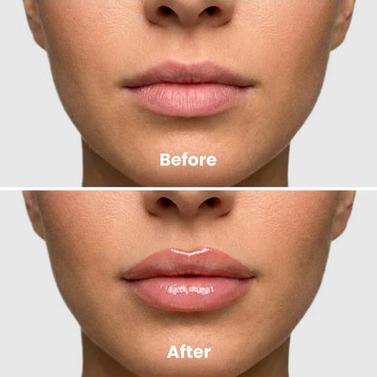 Voluxe™ Extreme Lip Plumper